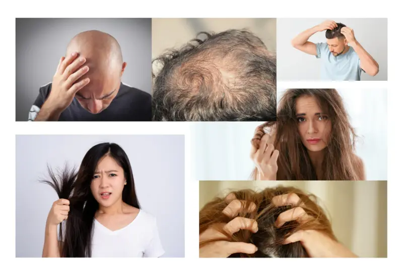 Common Hair Problems and Their Causes
